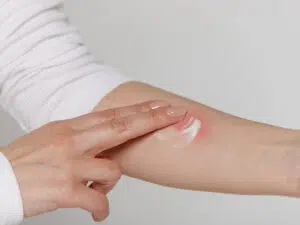 arnika